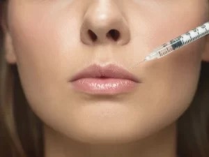 Tratamiento arrugas labios
