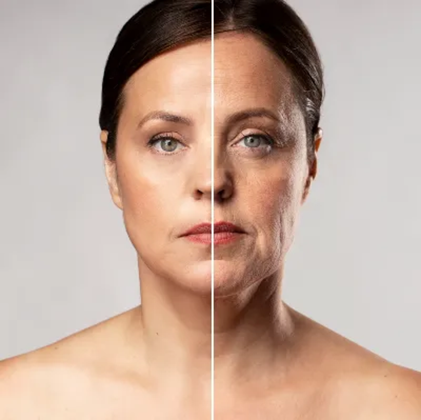 tratamientos de rejuvenecimiento facial antes y después